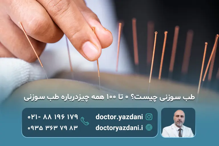 انجام طب سوزنی
